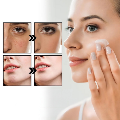 Kalmerende herstellende crème voor rosacea en roodheid – CALMAURA RELIEF - Glamorix