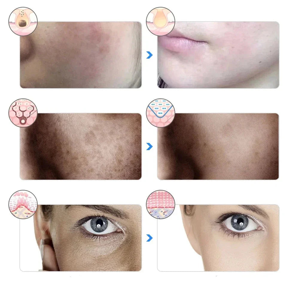 7-kleuren LED-therapiemasker voor huidverjonging en lifting – LUMISKIN AGEGLOW - Glamorix