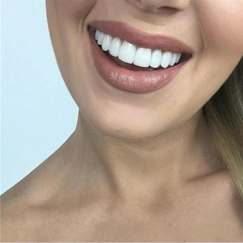 Comfortabele klikprothese voor een stralende glimlach – BRIGHTBITE EASY - Glamorix