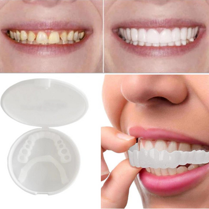 Comfortabele klikprothese voor een stralende glimlach – BRIGHTBITE EASY - Glamorix